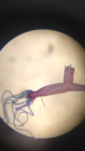 Hydra- note the tentacles, nematocyst, mouth, and bud